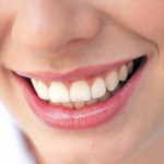 Jolies dents