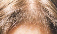 cheveux